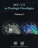 PET_CT_9786070229725_MEXICO_SILU4