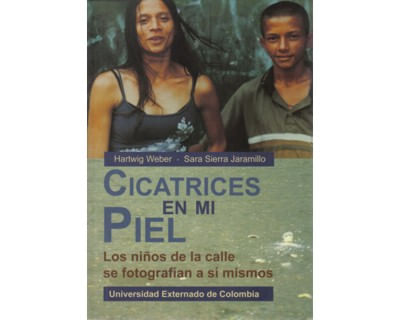 522_cicatrices_en_mi_piel_uext