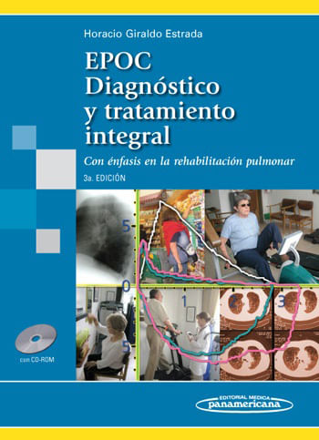 EPOC Diagnóstico y tratamiento integral Con énfasis en la rehabilitación pulmonar 3ª edición