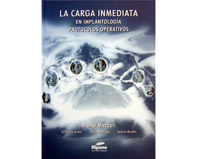 04_carga_inmediata_ripa