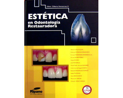 Estética en odontología restauradora