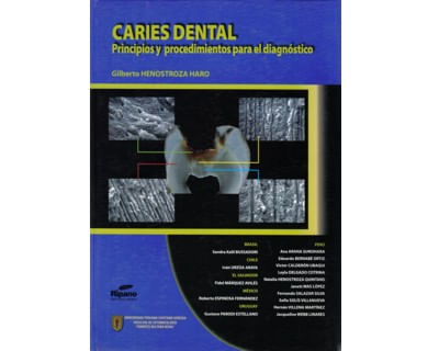 30_caries_dental_ripa
