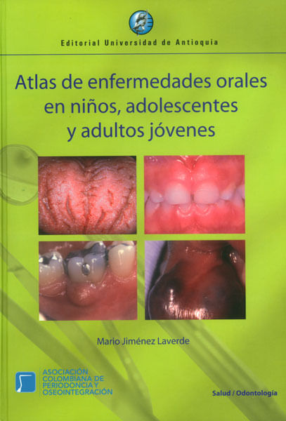 Atlas de enfermedades orales en niños adolescentes y adultos jóvenes