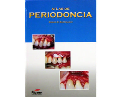 05_periodoncia_ripa