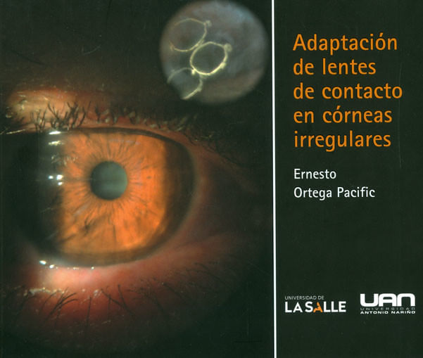 adaptacion-de-lentes-de-contacto-en-corneas-irregulares-9789588687902-uana