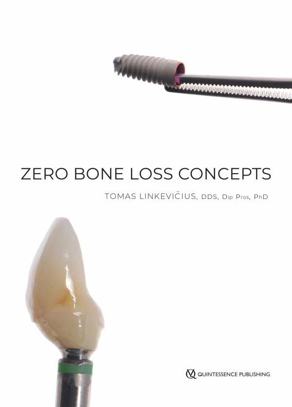 bw-zero-bone-loss-concepts-quintessence-publishing-co-inc-9780867158342