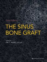 bw-the-sinus-bone-graft-quintessence-publishing-co-inc-9780867158380