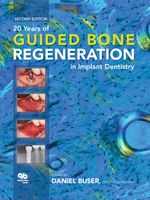 bw-20-years-of-guided-bone-regeneration-in-implant-dentistry-quintessence-publishing-co-inc-9780867159967