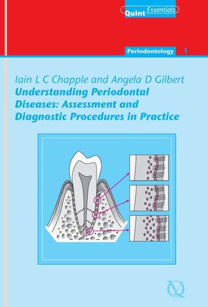 Understanding Periodontal Diseases: Assessment and Diagnostic Procedures in Practice
