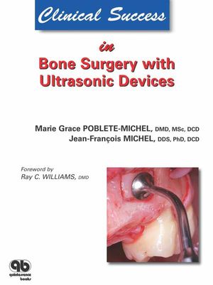 Clinical Success in Bone Surgery with Ultrasonic Devices