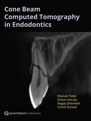 Cone Beam Computed Tomography in Endodontics