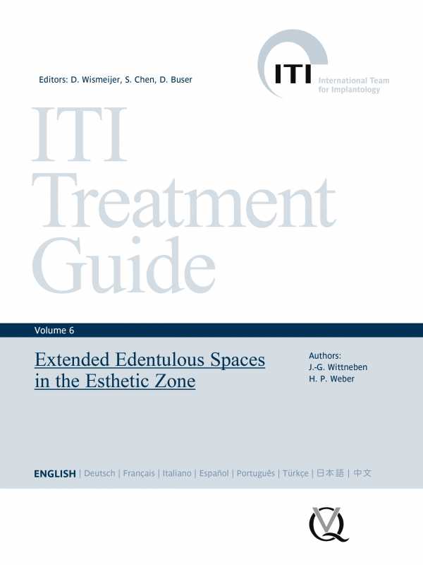 bw-extended-edentulous-spaces-in-the-esthetic-zone-quintessence-publishing-9783868674972