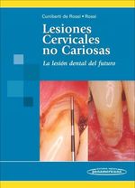 cel-lesiones-cervicales-no-cariosas-panamericana-
