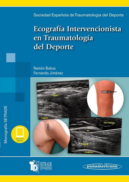 Setrade:ecografia Interv.traum.deporte+E