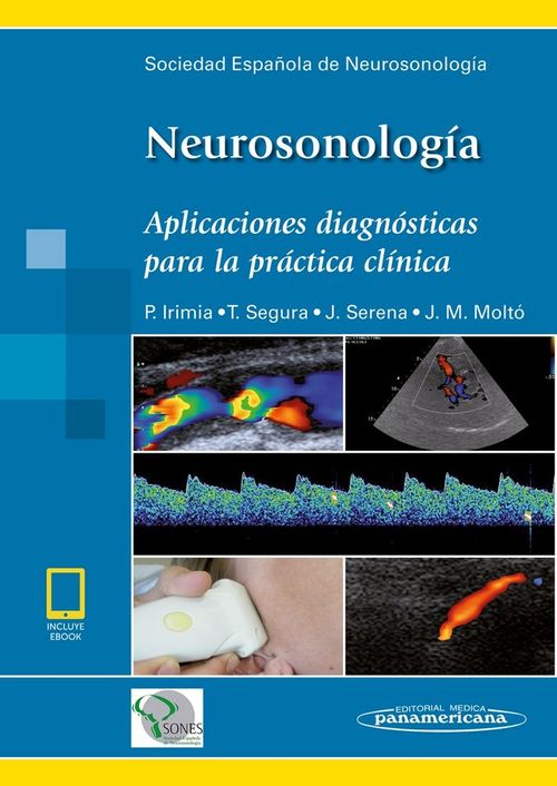 Neurosonología (Incluye Ebook)