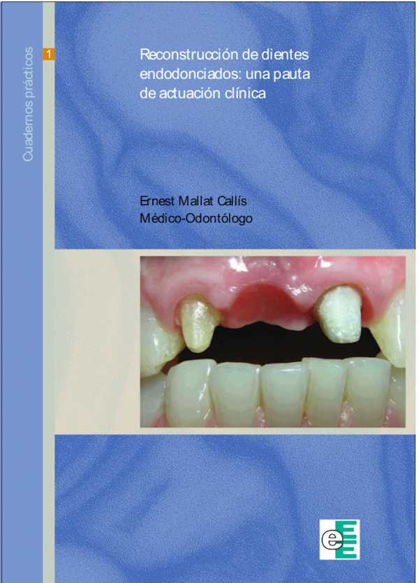 bw-reconstruccioacuten-de-dientes-endodonciados-ediciones-especializadas-europeas-9788494030543