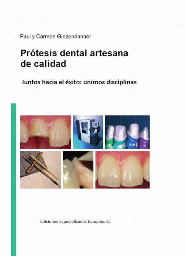 bw-proacutetesis-dental-artesanal-de-calidad-ediciones-especializadas-europeas-9788494173912