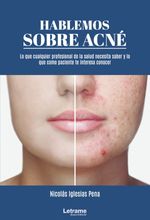 bm-hablemos-sobre-acne-letrame-9788413861357