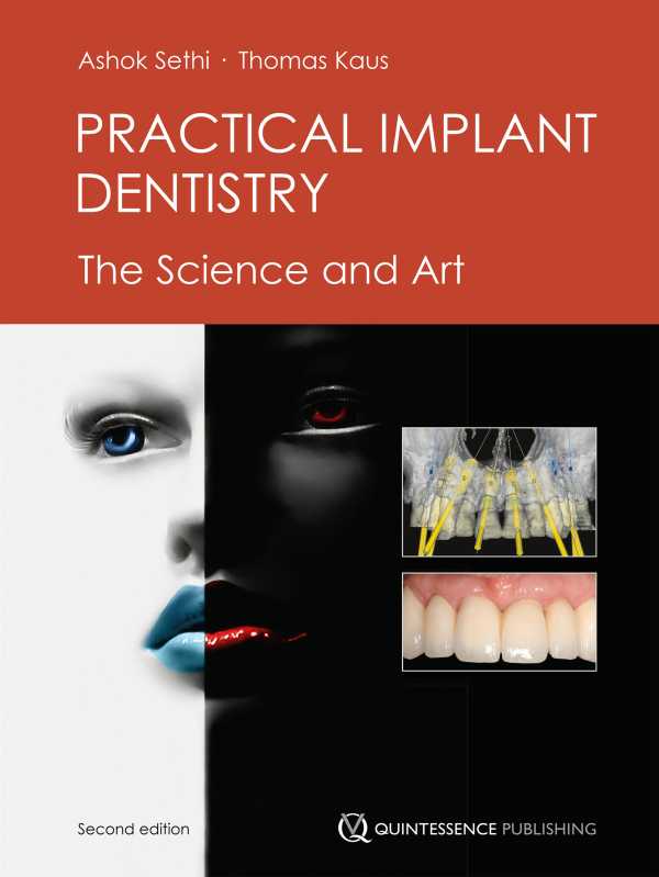 bw-practical-implant-dentistry-quintessenz-verlag-9781850974000