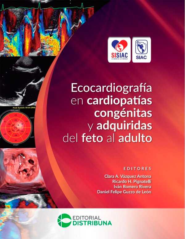 bw-ecocardiografiacutea-en-cardiopatiacuteas-congeacutenitas-y-adquiridas-del-feto-al-adulto-distribuna-editorial-mdica-9789585577732