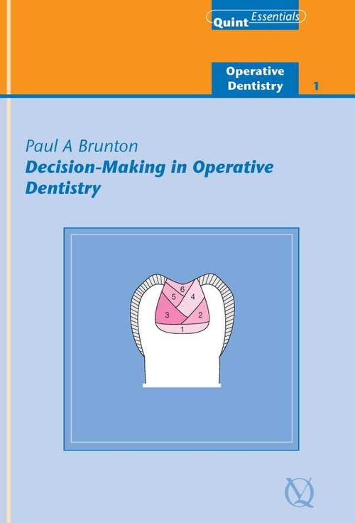 DecisionMaking in Operative Dentistry