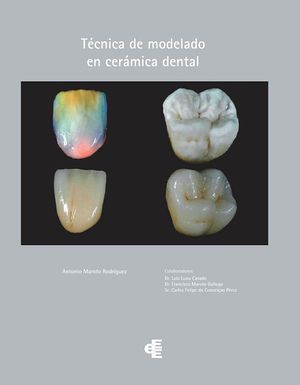 Técnica de modelado en cerámica dental