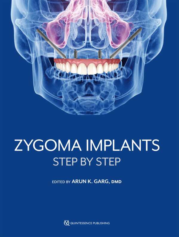 bw-zygoma-implants-quintessence-publishing-co-inc-9781647241582