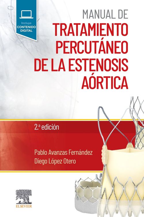 Manual De Trtamiento Percutanero De La Estenosis Aortica