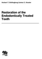 bw-restoration-of-the-endodontically-treated-tooth-quintessence-publishing-co-inc-9781647240158