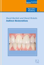 bw-indirect-restorations-quintessence-publishing-co-ltd-9781850973010
