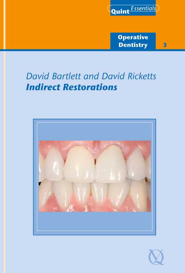 bw-indirect-restorations-quintessence-publishing-co-ltd-9781850973010