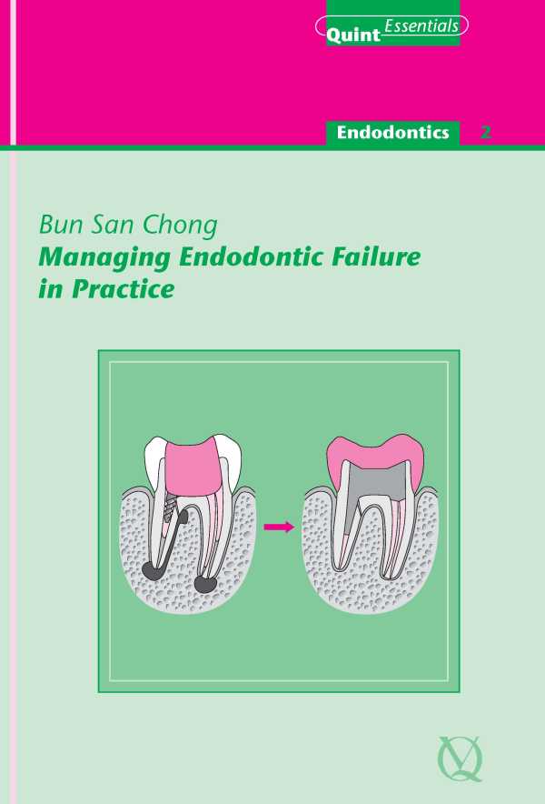 bw-managing-endodontic-failure-in-practice-quintessence-publishing-co-ltd-9781850973096
