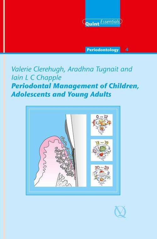 Periodontal Management of Children Adolescents and Young Adults