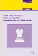bw-interpreting-dental-radiographs-quintessence-publishing-co-ltd-9781850973164