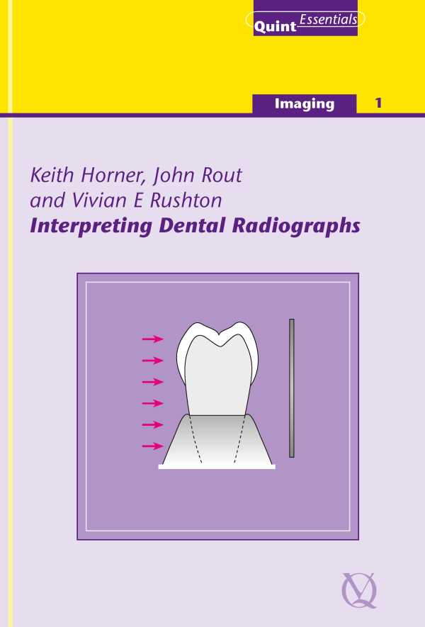 bw-interpreting-dental-radiographs-quintessence-publishing-co-ltd-9781850973164
