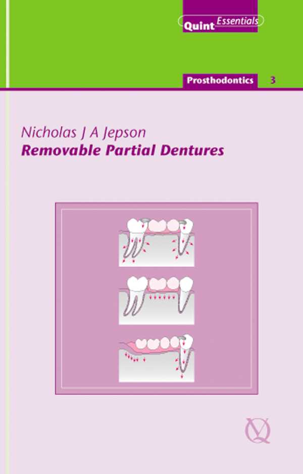 bw-removable-partial-dentures-quintessence-publishing-co-ltd-9781850973188