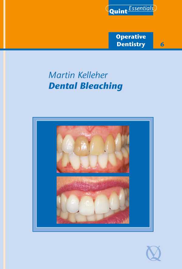 bw-dental-bleaching-quintessence-publishing-co-ltd-9781850973195
