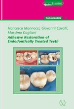 bw-adhesive-restoration-of-endodontically-treated-teeth-quintessence-publishing-co-ltd-9781850973218
