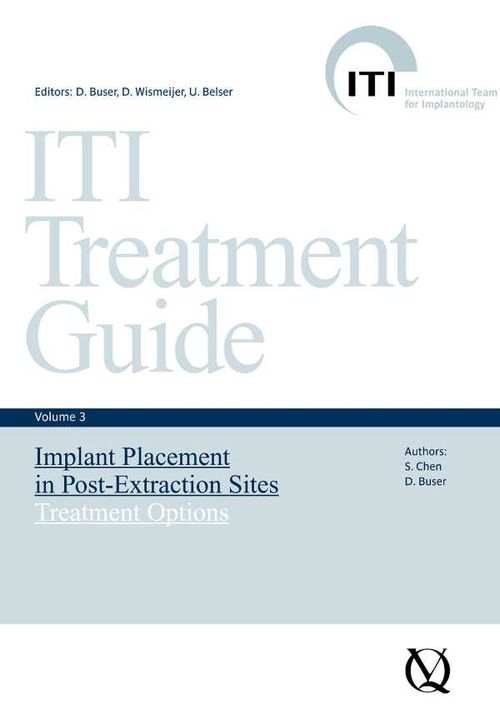 Implant Placement in PostExtraction Sites
