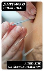 bw-a-treatise-on-acupuncturation-digicat-8596547058632