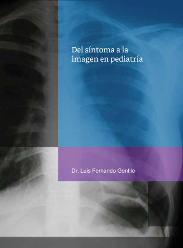 bw-del-siacutentoma-a-la-imagen-en-pediatriacutea-libella-ediciones-9789878844213