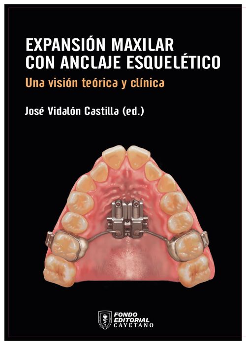 Expansión maxilar con anclaje esquelético