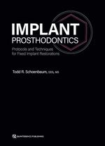 bw-implant-prosthodontics-quintessence-publishing-co-inc-9781647242039
