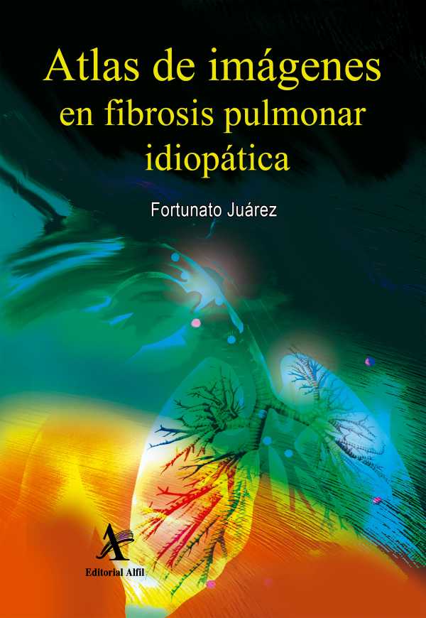 bw-atlas-de-imaacutegenes-en-fibrosis-pulmonar-idiopaacutetica-editorial-alfil-9786077414933