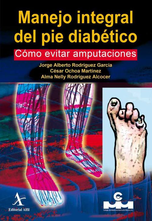 Manejo integral del pie diab?tico C?mo evitar amputaciones