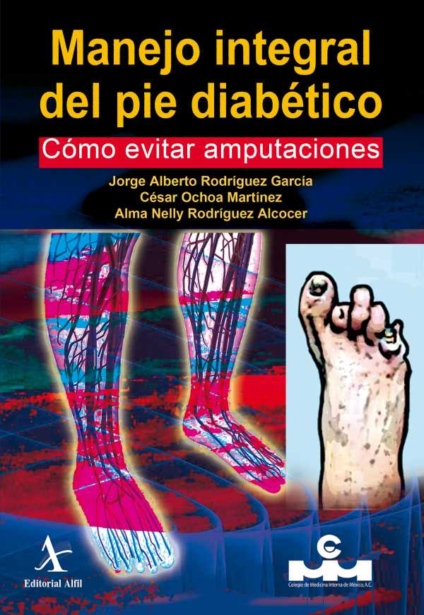 bw-manejo-integral-del-pie-diabeacutetico-coacutemo-evitar-amputaciones-editorial-alfil-9786077415886