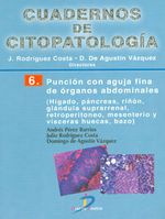 216_puncion_diaz