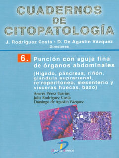 216_puncion_diaz