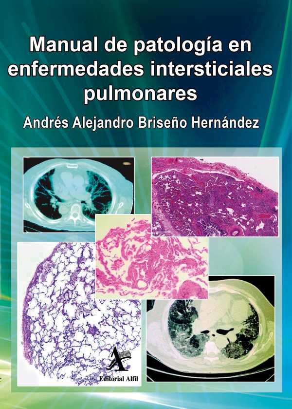 bw-manual-de-patologiacutea-en-enfermedades-intersticiales-pulmonares-editorial-alfil-9786077415893