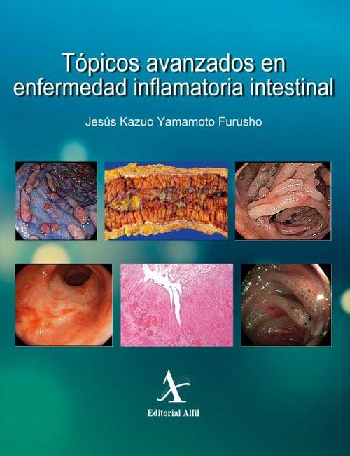 Tópicos avanzados en enfermedad inflamatoria intestinal